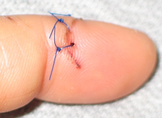 finger 7